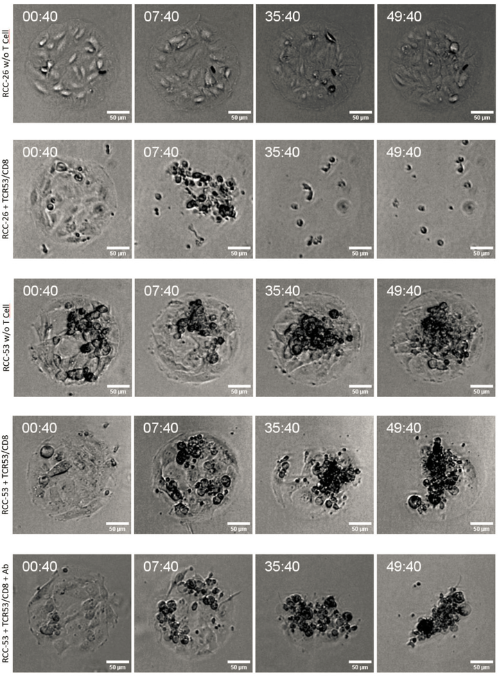 T 细胞杀伤实验：ibidi μ-Pattern 微区块上的「八角笼中」