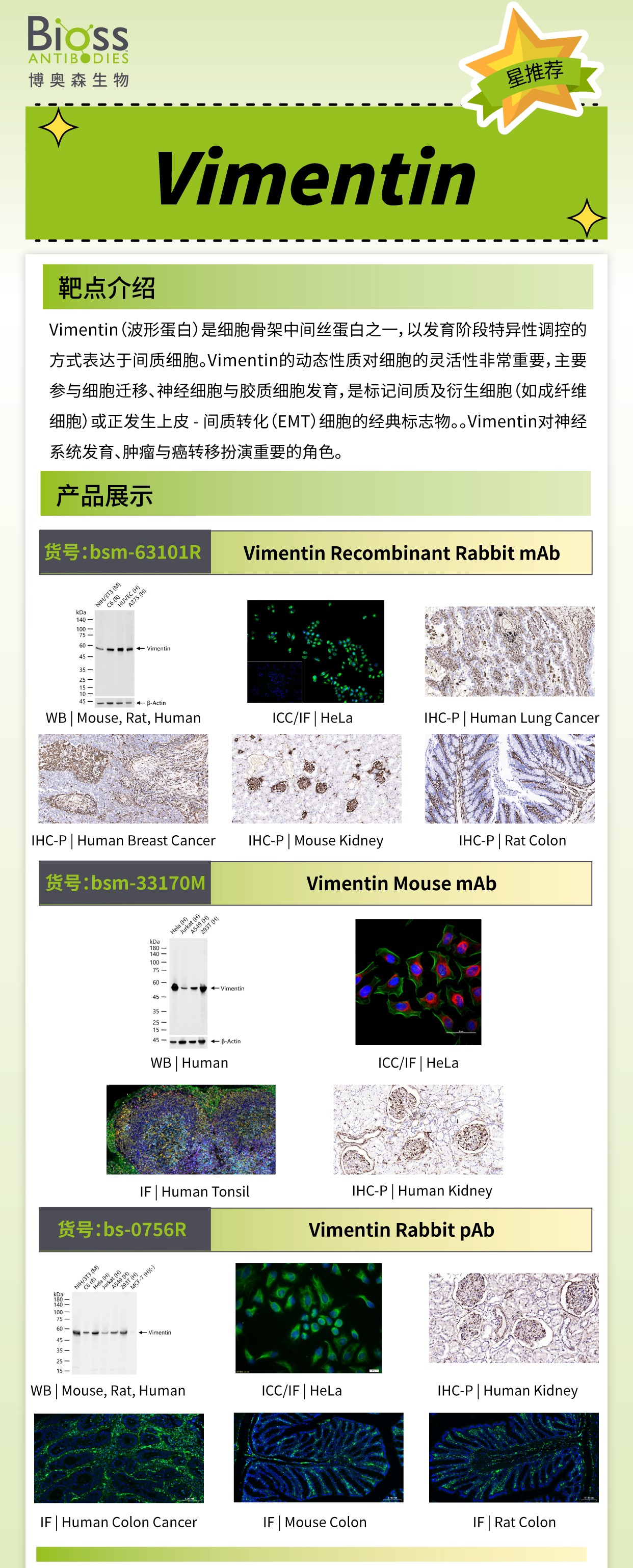 博奥森星推荐 | Vimentin 抗体