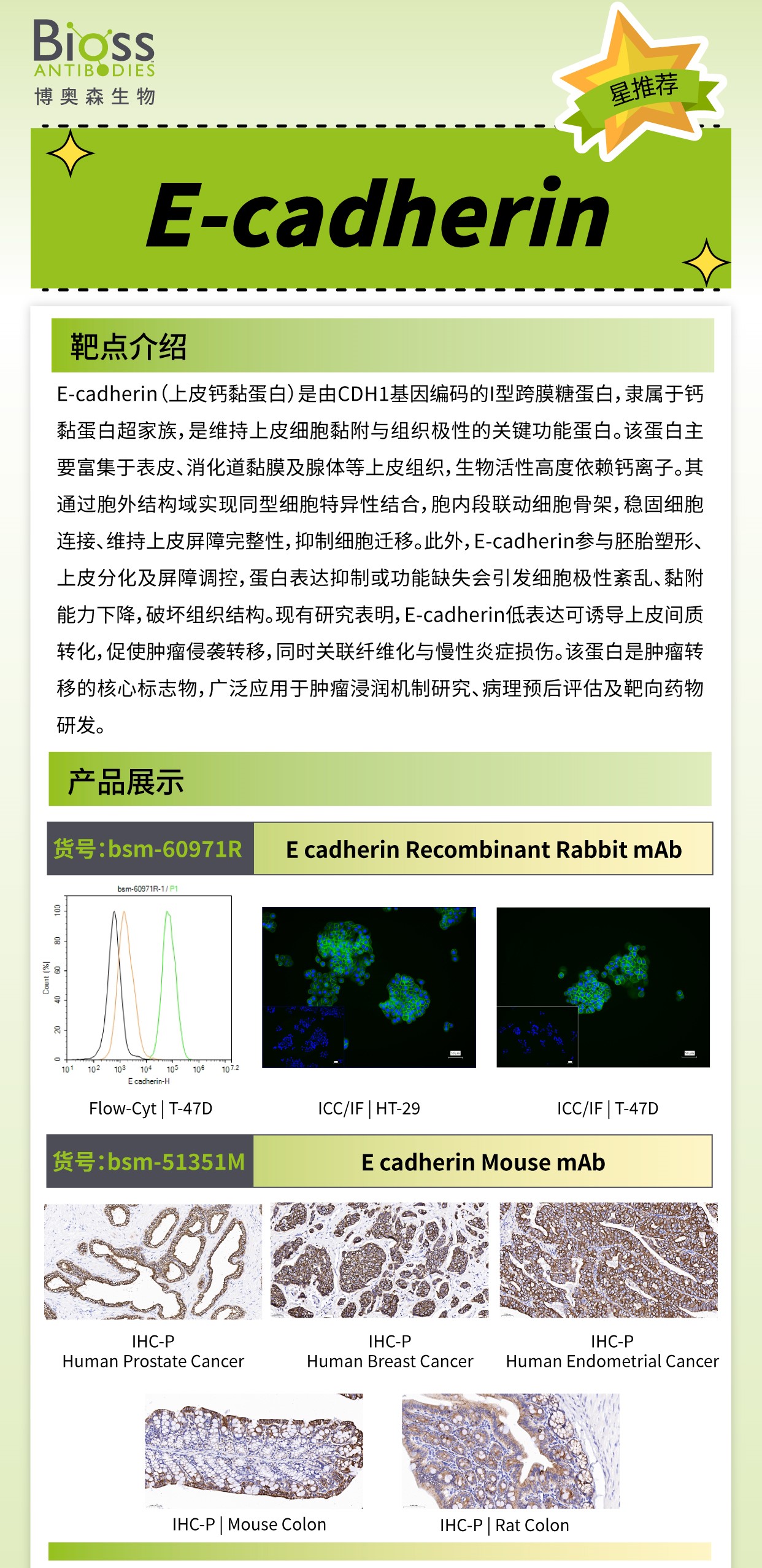 博奥森星推荐 | E cadherin 抗体