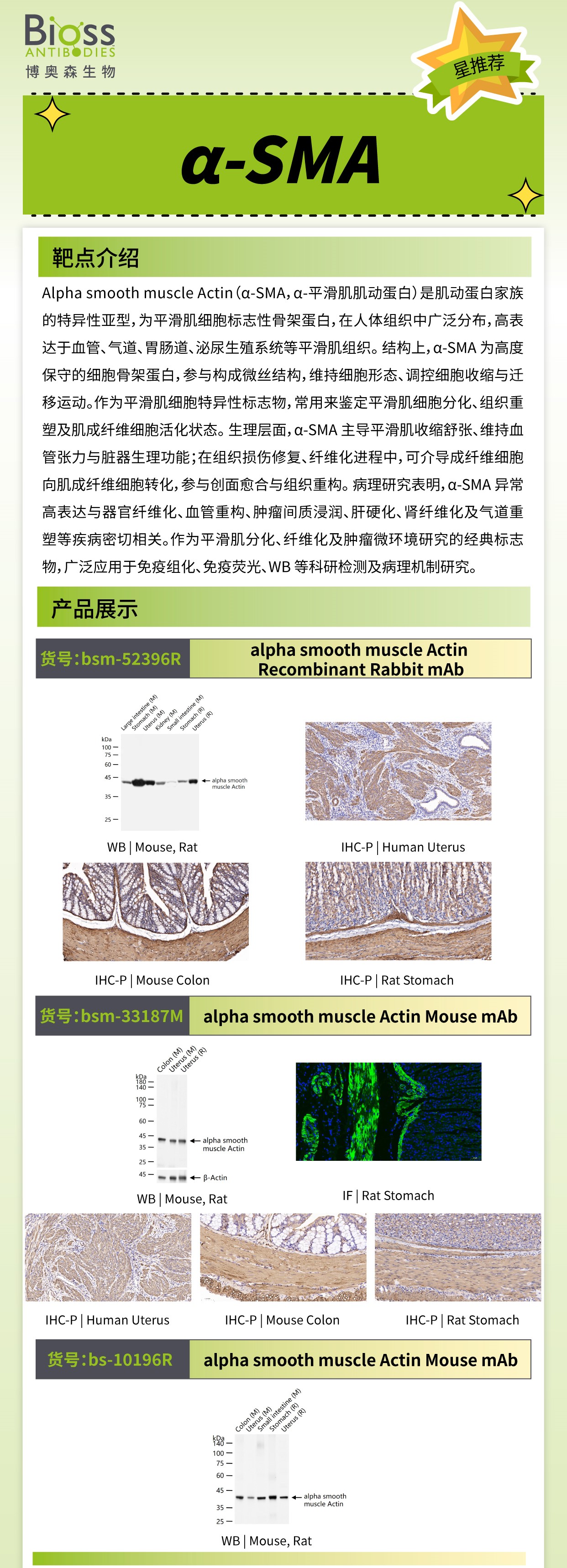 博奥森星推荐 | α-SMA 抗体
