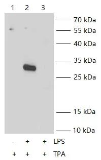 【新品推荐】Biorbyt KO/KD验证 ELISA试剂盒，为蛋白表达分析提供更可靠依据