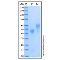 Recombinant Human Coagulation Factor Xa Protein，无