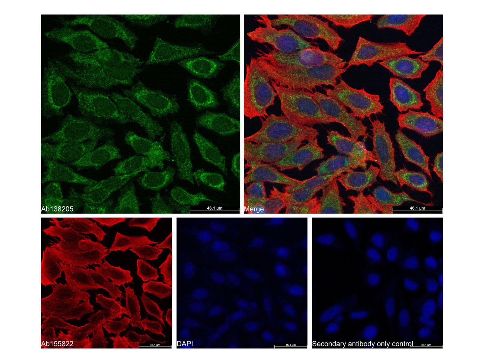 Goat Anti-Rabbit IgG H&L (AF488),ExactAb™, 高性能, 已验证, Ex:490nm, Em:525nm, 1 mg/mL,阿拉丁