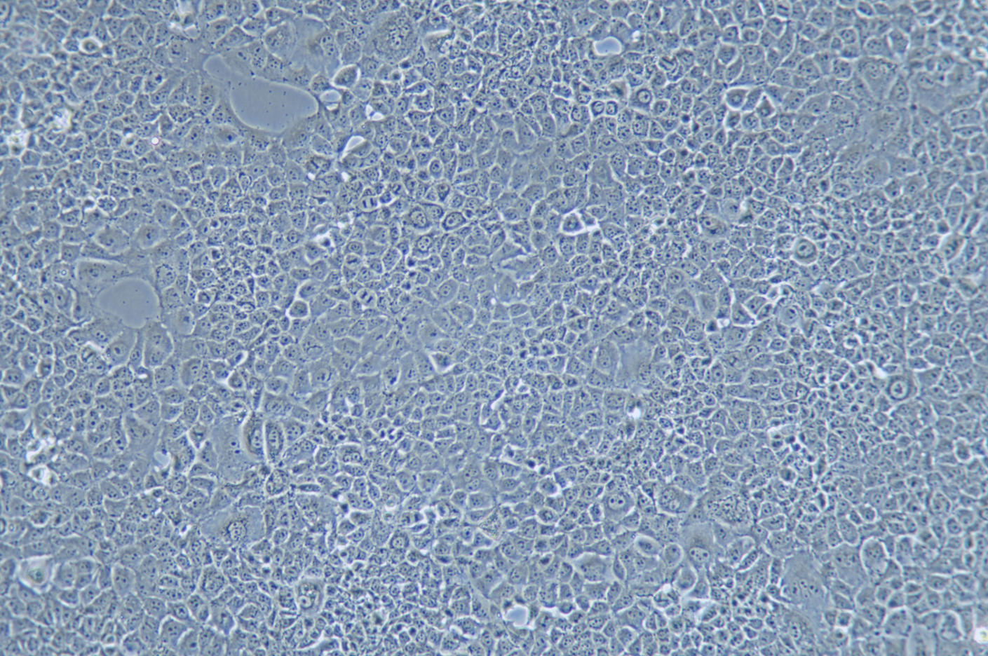 AML12 |AML12细胞|AML-12|AML-12细胞|AML-12小鼠肝细胞/种属鉴定/镜像绮点(Cellverse)产品图