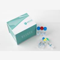 Human残留DNA检测试剂盒（PCR-荧光探针法）
