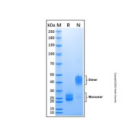 Recombinant Rat VEGF 164 Protein,无动物源, 无载体, 重组, ActiBioPure™, 高性能, ≥95%(SDS-PAGE),阿拉丁