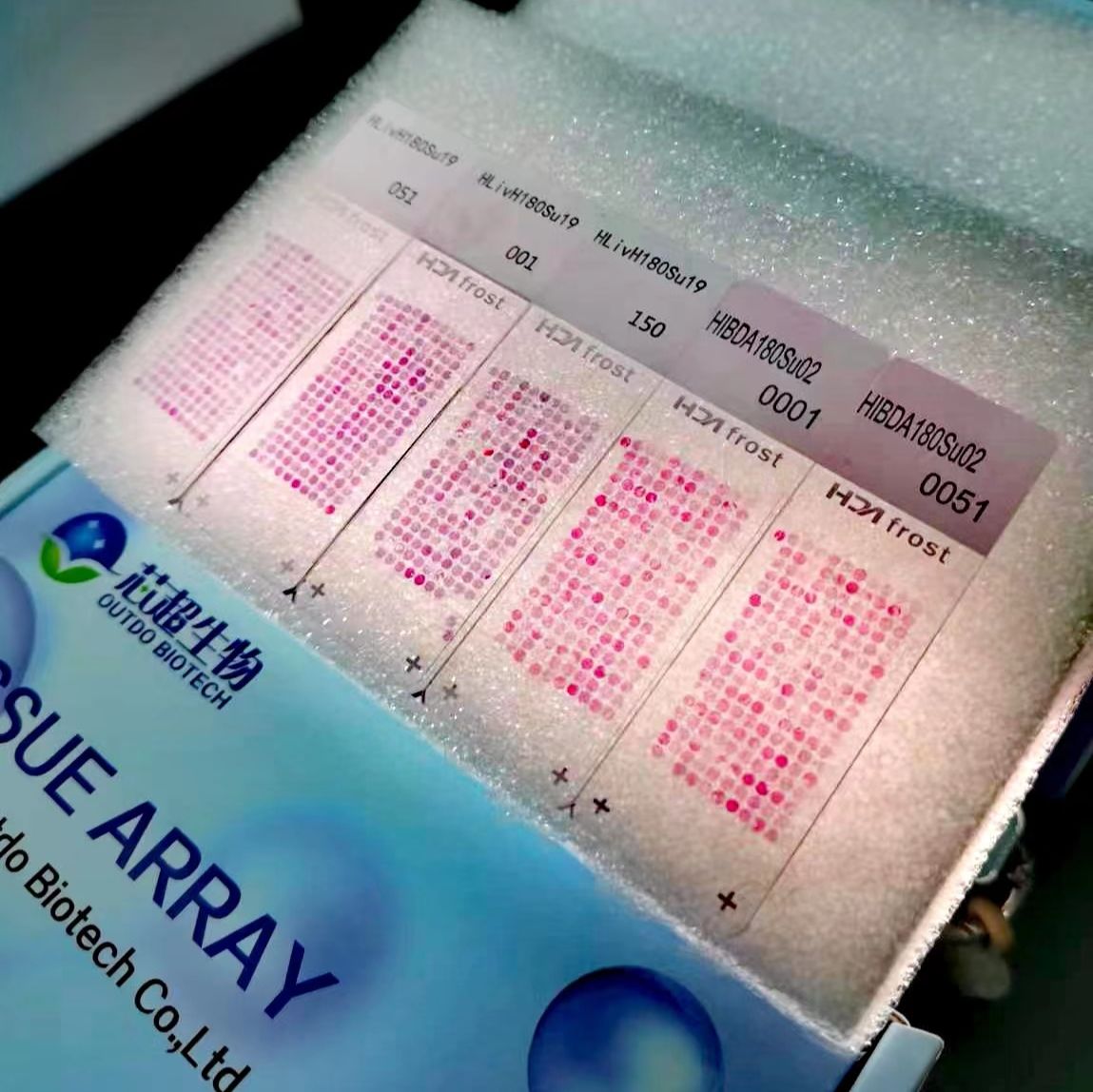 胃癌复发转移组织芯片产品图