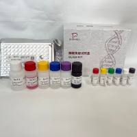 猪(Porcine)钙/钙调蛋白依赖性蛋白激酶II α(CAMK2α)ELISA检测试剂盒