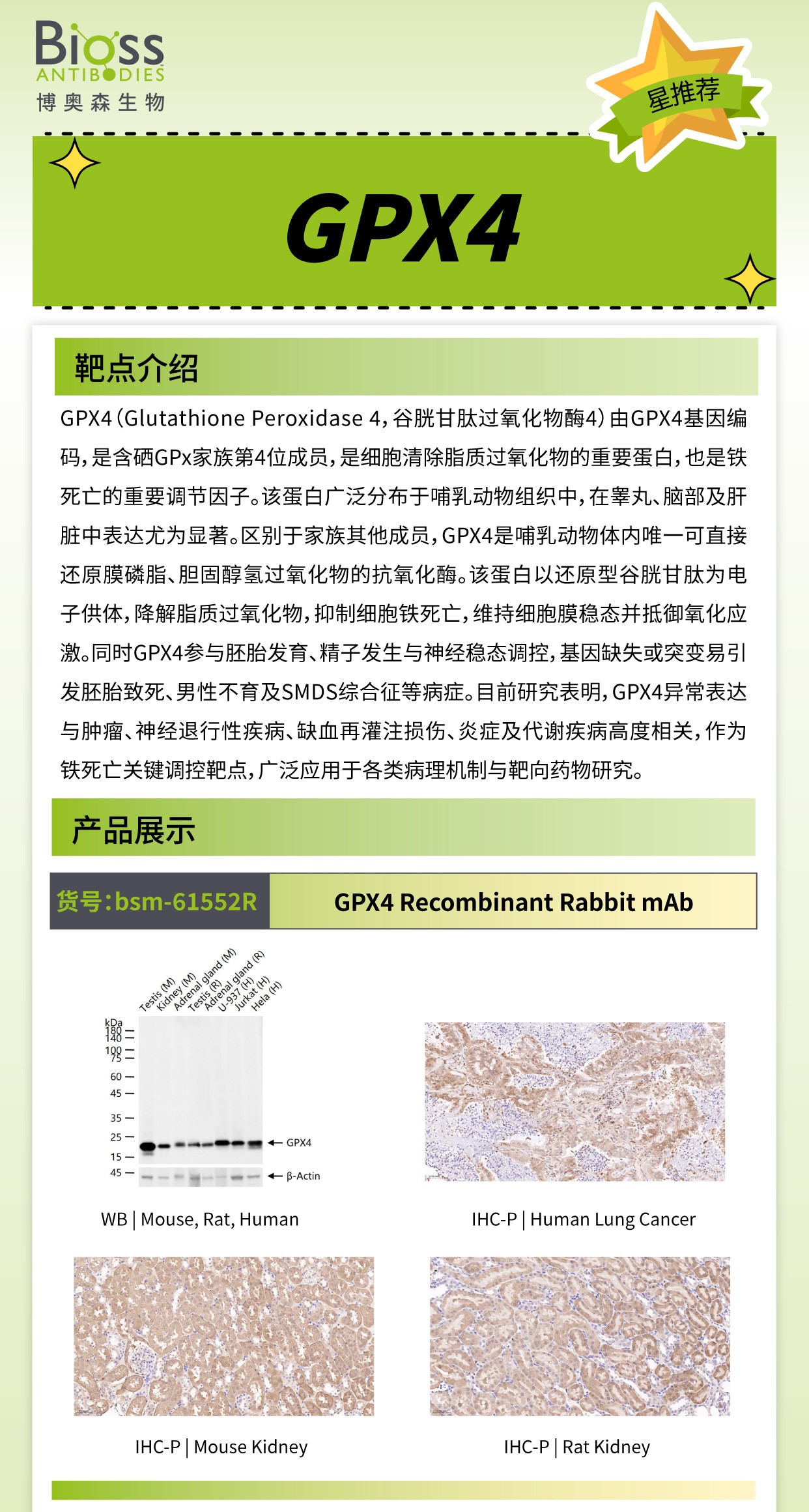博奥森星推荐 | GPX4 抗体
