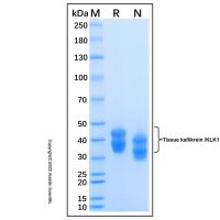 Recombinant Human Kallikrein 1 Protein，无动物源,无载体,His标签,≥95%(SDS-PAGE),见COA，阿拉丁