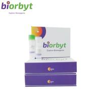 Human Tau Mouse Monoclonal Antibody 抗体，orb1291586，Biorbyt