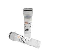 Anti-Human TSHR/LGR3 Antibody (M22), 抗人TSHR/LGR3抗体 (M22)