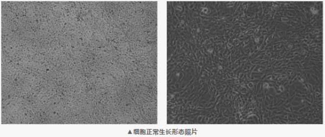 786-O(人肾透明细胞腺癌细胞)培养指南