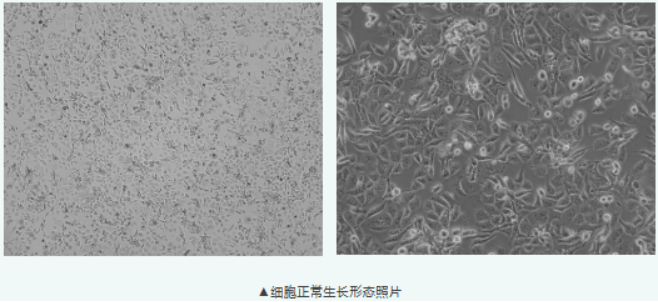 NCI-H446人小细胞肺癌细胞培养全攻略：从基本信息到实操要点