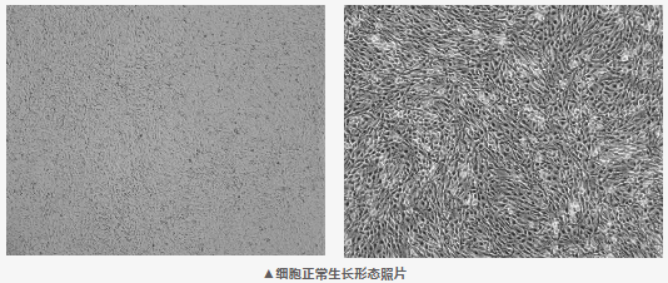 PC-12(高分化)大鼠肾上腺嗜铬细胞瘤细胞培养指南
