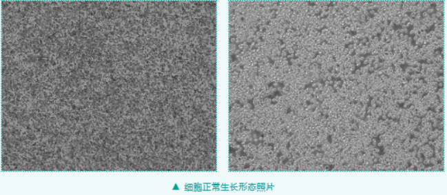 HEL人红白细胞白血病细胞培养指南