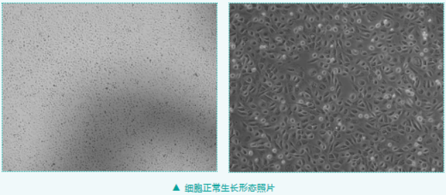 ID8小鼠卵巢上皮癌细胞培养指南