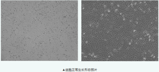 Vero(非洲绿猴肾细胞)培养指南