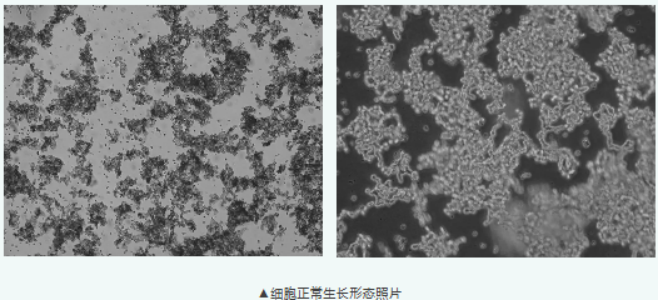 NCI-H526(人小细胞肺癌细胞)培养指南