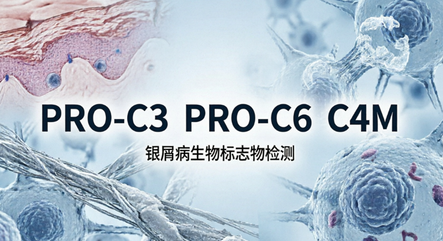银屑病研究新视角：三项细胞外基质（ECM）片段或成潜在生物标志物