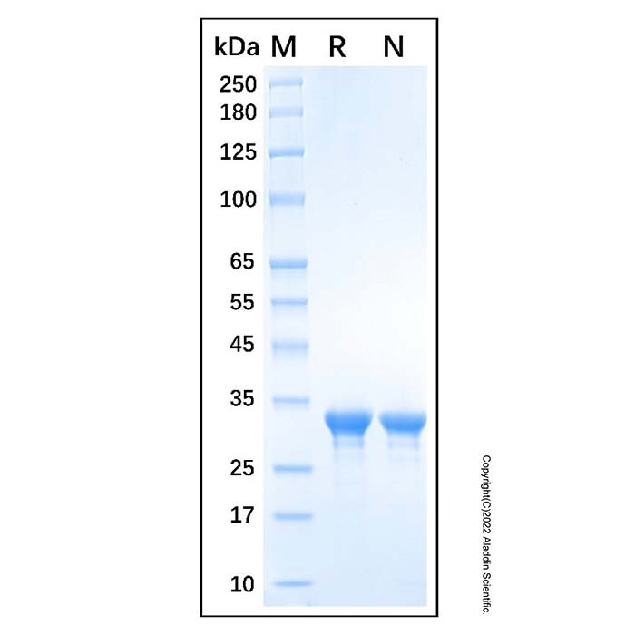 Recombinant Human HMGN1 Protein,无载体,His标签,SUMO标签,≥90%(SDS-PAGE),见COA,阿拉丁产品图
