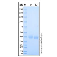 Recombinant Human RSPO1 Protein，无动物源,无载体,生物活性,ActiBioPure™,高性能,His标签,≥95%(SDS-PAGE), ，阿拉丁