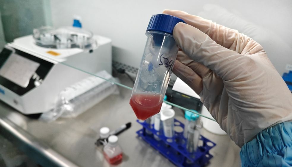 肺组织的纤维网架：单细胞悬液制备中酶解策略的选择与优化