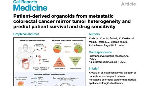 肠癌耐药？类器官筛选为晚期肠癌患者谋生机