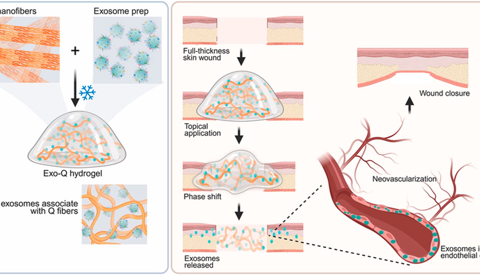 Biomaterials｜NYU团队：两阶段释放+血管靶向，“二合一”外泌体水凝胶单次给药缩短糖尿病伤口愈合时间88.9%，疗效碾压PDGF-BB