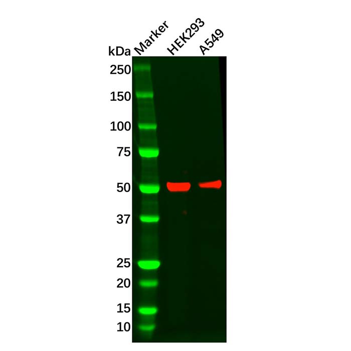 Recombinant Wilms Tumor Protein Antibody,ExactAb™, Validated, 重组, 0.6 mg/mL,阿拉丁