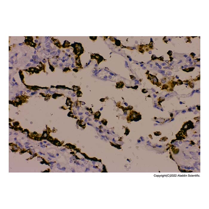 Recombinant NAPSIN A Antibody，ExactAb™, Validated, Carrier Free, Recombinant, 0.2 mg/mL，阿拉丁产品图