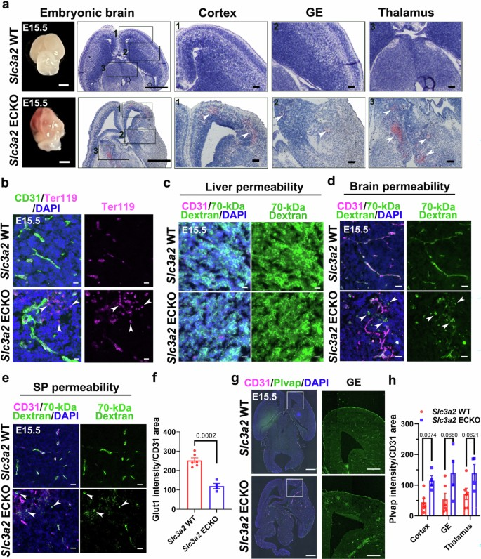 BMG LABTECH多功能酶标仪文献分享,深圳弯实验室连同吉林大学发表在Nature Cardiovascular Research “CD98hc controls CNS angiogenesis and blood–brain barrier integrity through localized regulation of the systemic integrin–FAK pathwa