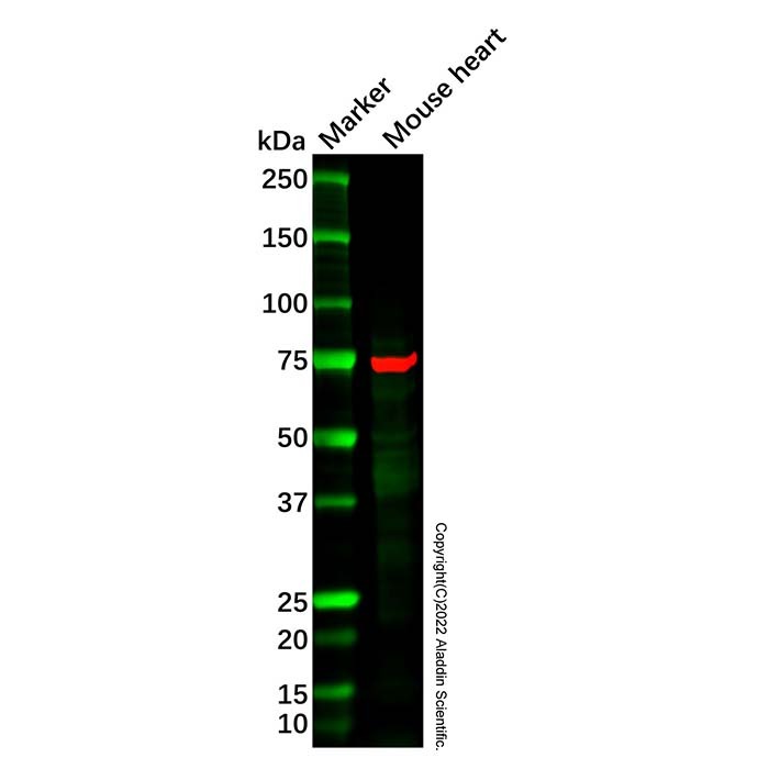 15 Lipoxygenase 1/ALOX15 Antibody，已验证, ExactAb™, 1.0 mg/mL，阿拉丁