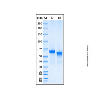 Recombinant Human MMP-14/MT1-MMP Protein，无动物源,无载体,生物活性,ActiBioPure™,His标签,≥85%(SDS-PAGE),见COA，阿拉丁