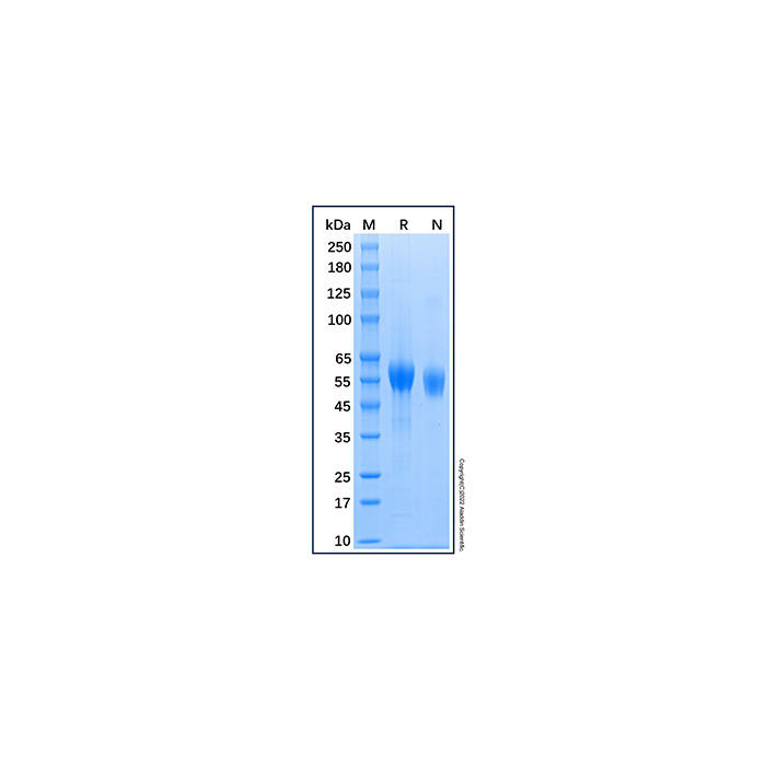 Recombinant Human DDR1 Protein,无动物源,无载体,His标签,PBS Only,≥95%(SDS-PAGE),阿拉丁产品图