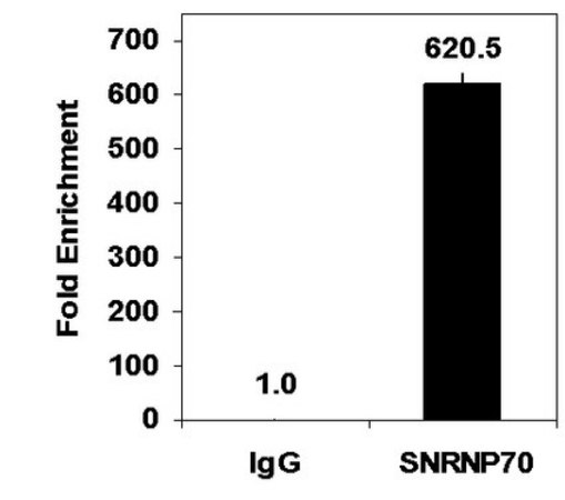 Magna RIP®RNA结合蛋白质免疫沉淀试剂盒 RNA Immunoprecipitation (RIP) Kit containing all necessary reagents to perform 12 individual RNA-binding protein immunoprecipitation (RIP) reactions using protein A/G magnetic beads.