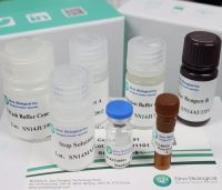 人干扰素γ酶联免疫试剂盒