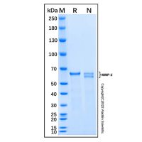 Recombinant Mouse MMP-2 Protein,无载体,His标签,≥95%(SDS-PAGE),expressed in E. coli; 见COA,阿拉丁