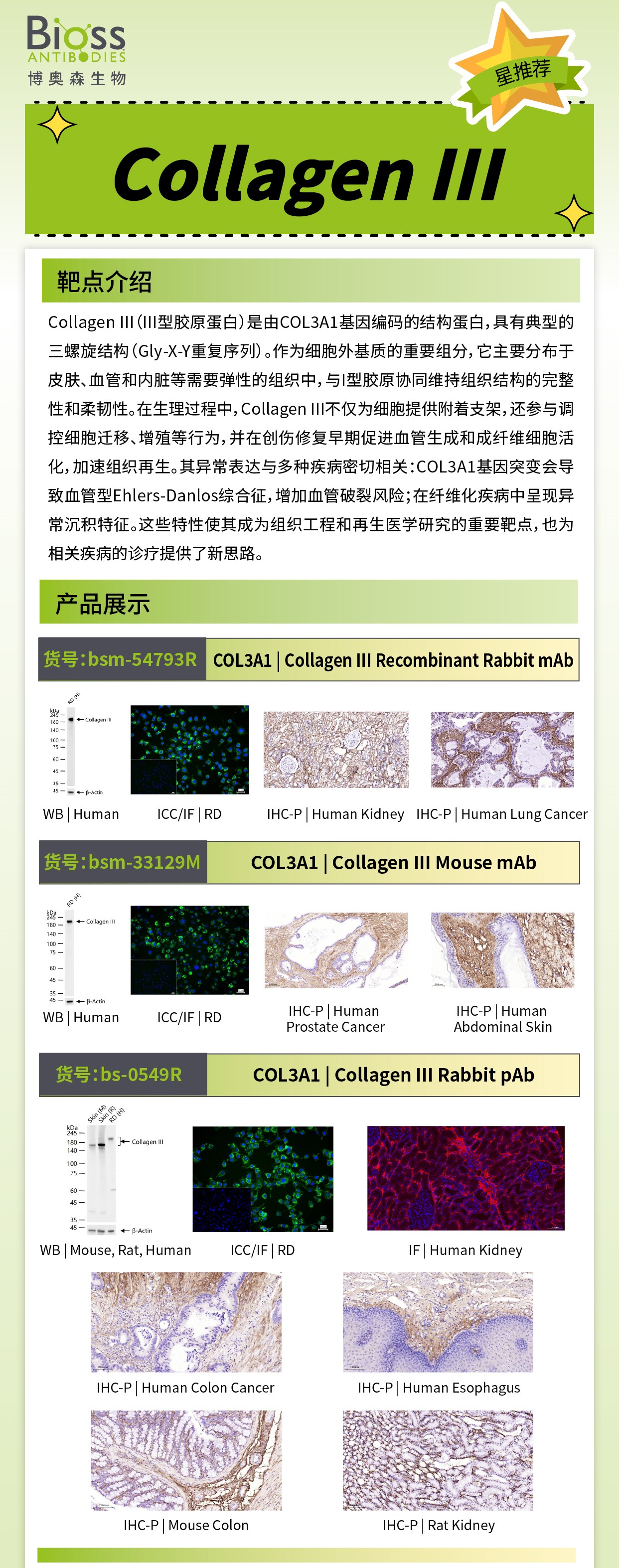 博奥森星推荐 | Collagen III 抗体