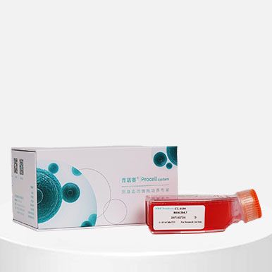 人子宫内膜上皮细胞(原代永生化)产品图
