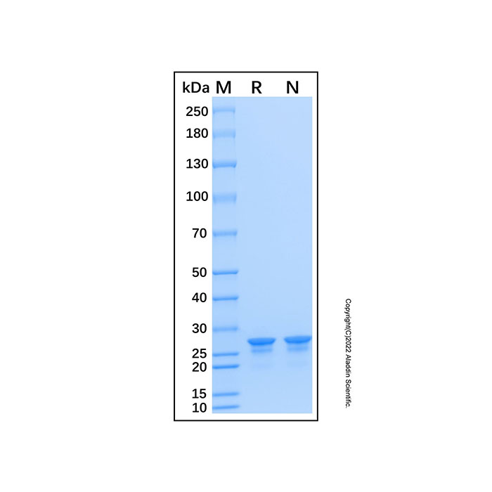 Recombinant Human CCDC25 Protein，无载体, His标签, ≥90%(SDS-PAGE), expressed in E. coli; 见COA，阿拉丁产品图