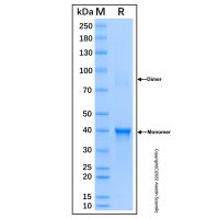 Recombinant Human TMPRSS2 Protein，无载体, His标签, ≥85%(SDS-PAGE), expressed in E. coli; 见COA，阿拉丁