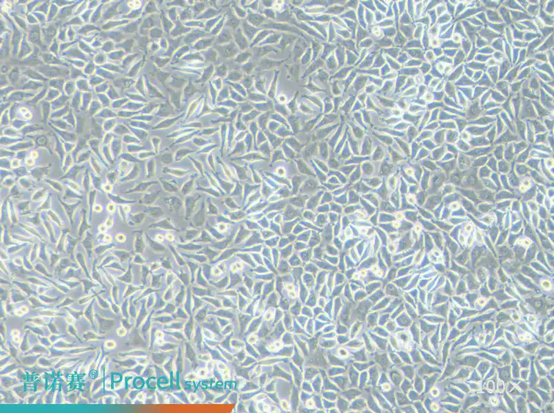 告别细胞污染困扰｜procell普诺赛NCTC clone 929 [L cell, L-929]，多重质检，成纤维体外实验好选择