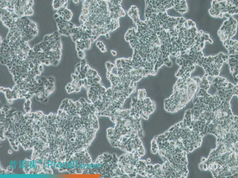 普诺赛MCF7 [MCF-7]细胞系：探索乳腺癌研究的经典细胞模型