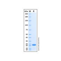 Recombinant Human DUSP13B Protein，无载体, His标签, ≥95%(SDS-PAGE), expressed in E. coli; 见COA，阿拉丁