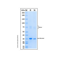 Recombinant Human Cyclin D2 Protein,无动物源, 无载体, His标签, ≥85%(SDS-PAGE), expressed in E. coli; 见COA,阿拉丁