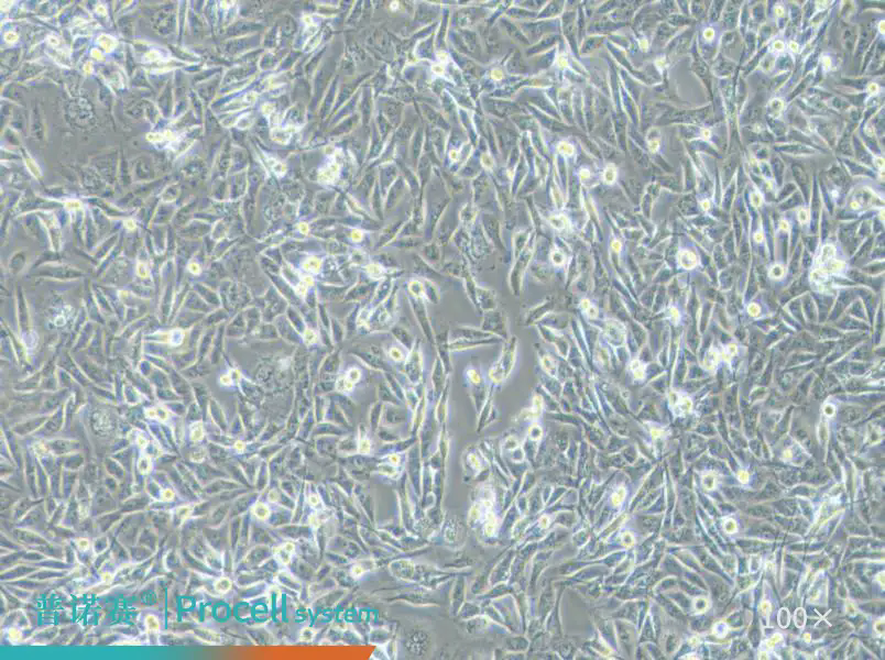 三阴性乳腺癌研究“标配”：普诺赛MDA-MB-231细胞，STR鉴定护航实验数据