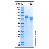 Recombinant Mouse PIR-B Protein，无动物源,无载体,生物