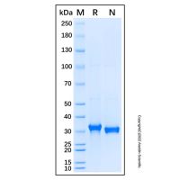 Recombinant Human IBPL1 Protein,无动物源, 无载体, His标签, ≥90%(SDS-PAGE), expressed in HEK293; 见COA,阿拉丁