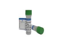 Recombinant Human SHBG Protein, His Tag